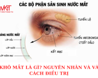 KHÔ MẮT LÀ GÌ? NGUYÊN NHÂN VÀ VÀ CÁCH ĐIỀU TRỊ